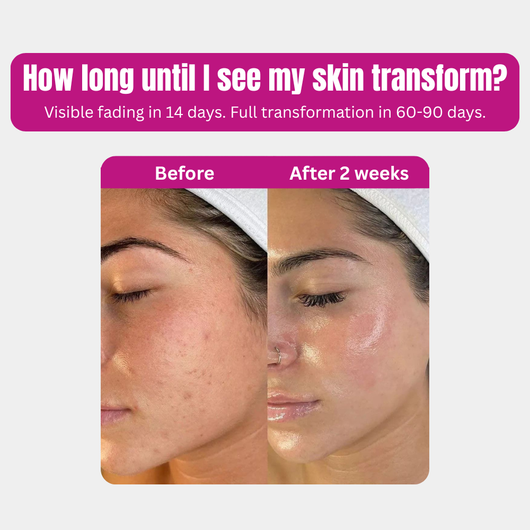 Advanced Dark Spots Corrector